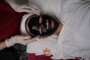 Hút chì thải độc da mặt là gì? Các bước thực hiện chuẩn y khoa – Skin Plus Dermatology