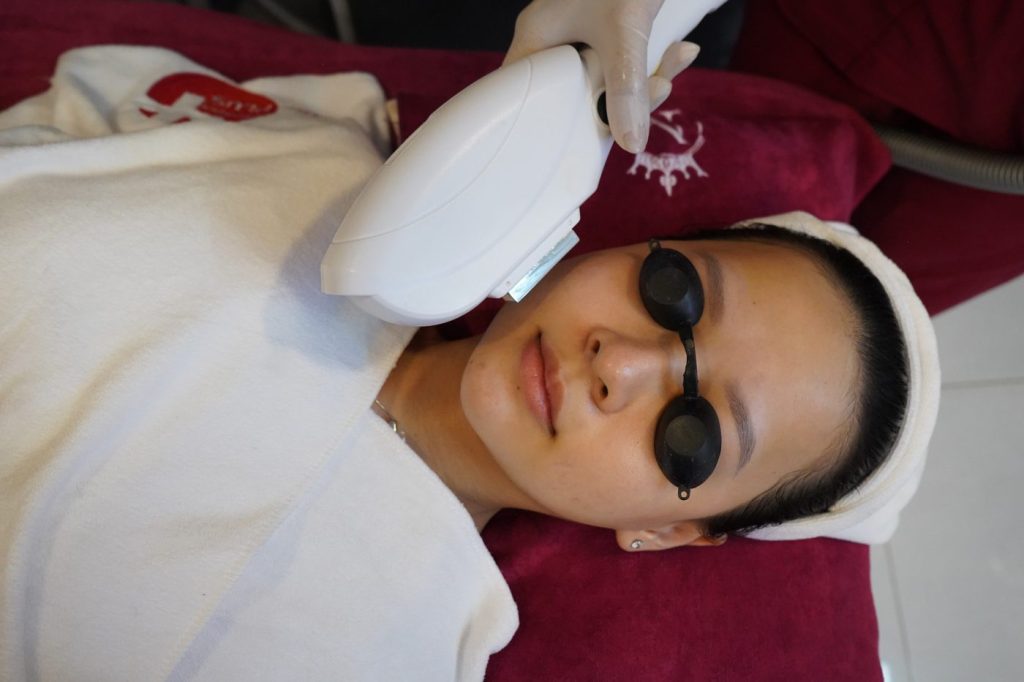 SLP Acne tại Skin Plus Dermatology