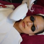 SLP Acne tại Skin Plus Dermatology