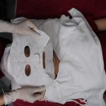 Mụn Detox CO2 tại Skin Plus Dermatology