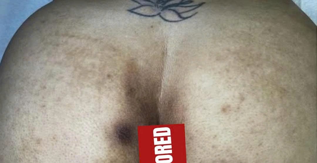Trước