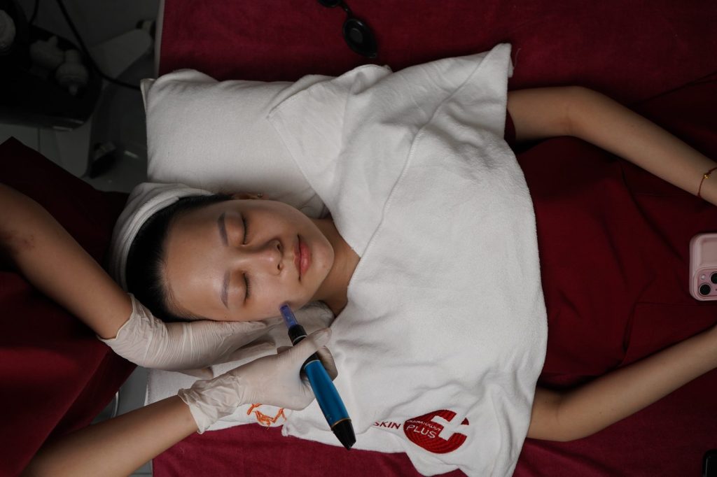 Siêu Vi Peel X3 Pro tại Skin Plus Dermatology