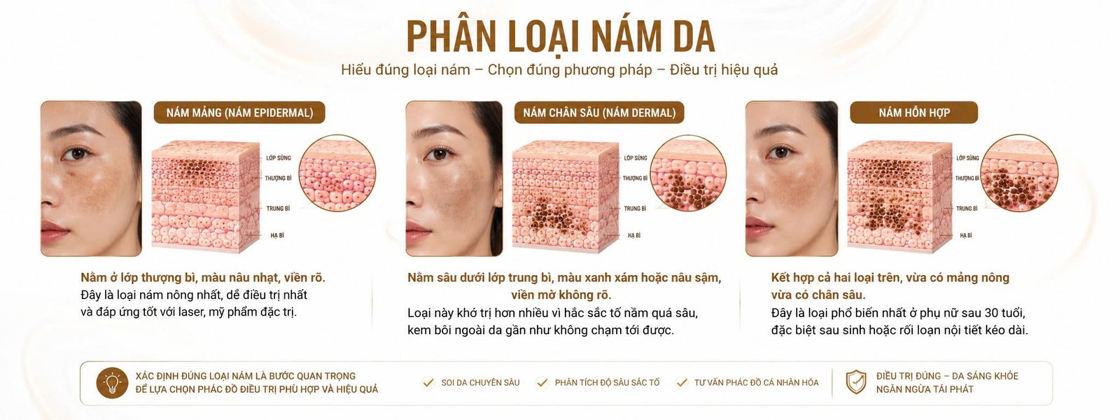MESOTHERAPY TRỊ NÁM - Skin Plus Dermatology