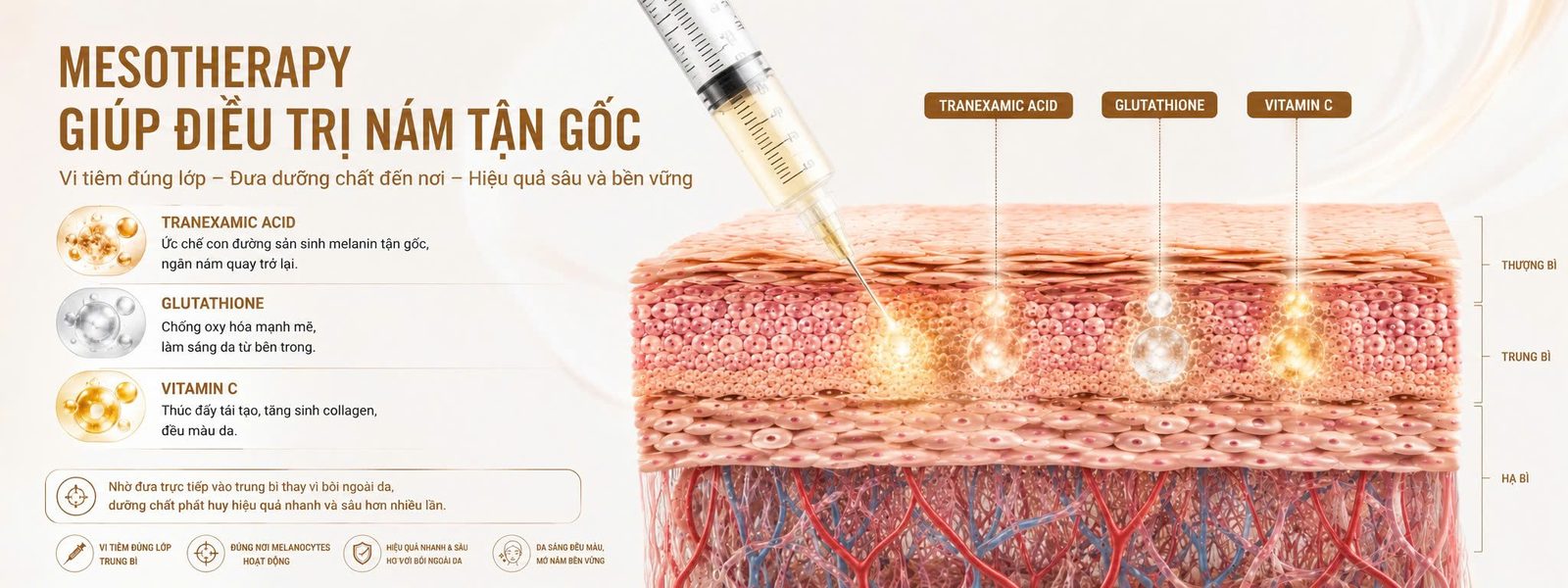MESOTHERAPY TRỊ NÁM - Skin Plus Dermatology