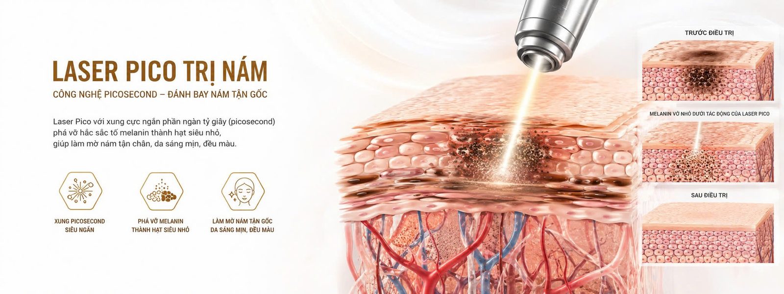 LASER PICO TRỊ NÁM - Skin Plus Dermatology