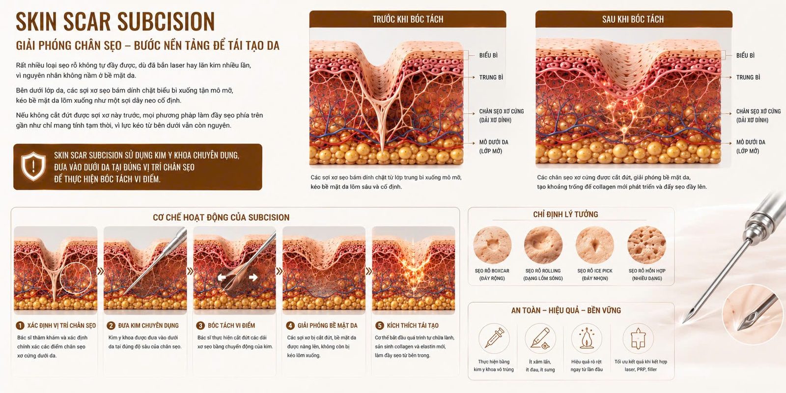 SKIN SCAR SUBCISION - Skin Plus Dermatology