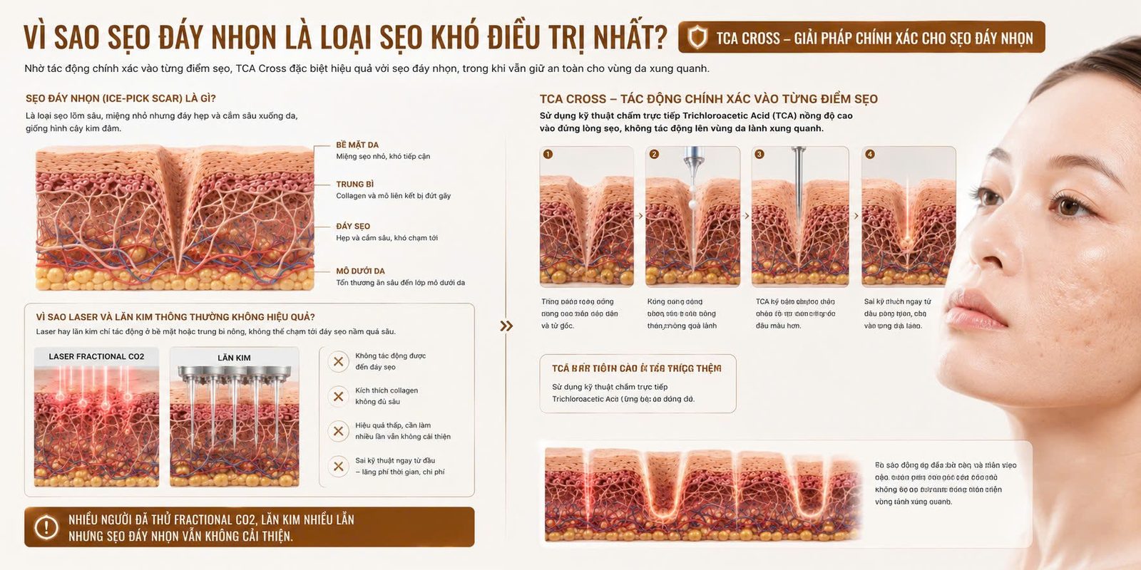 SKIN TCA CROSS - Skin Plus Dermatology