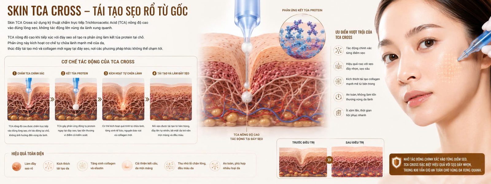 SKIN TCA CROSS - Skin Plus Dermatology